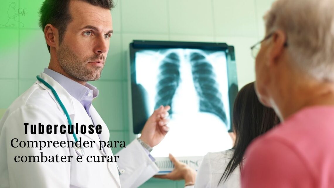 Raio-X de tórax, simbolizando o diagnóstico e as informações precisas sobre a tuberculose.