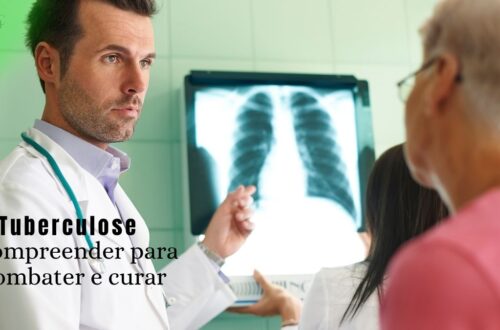 Raio-X de tórax, simbolizando o diagnóstico e as informações precisas sobre a tuberculose.