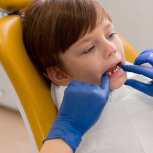 Criança sorrindo mostrando os primeiros dentes de leite